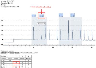 Spectrum of BCR-ABL mutations in Azerbaijanian imatinib-resistant patients with chronic myeloid leukemia